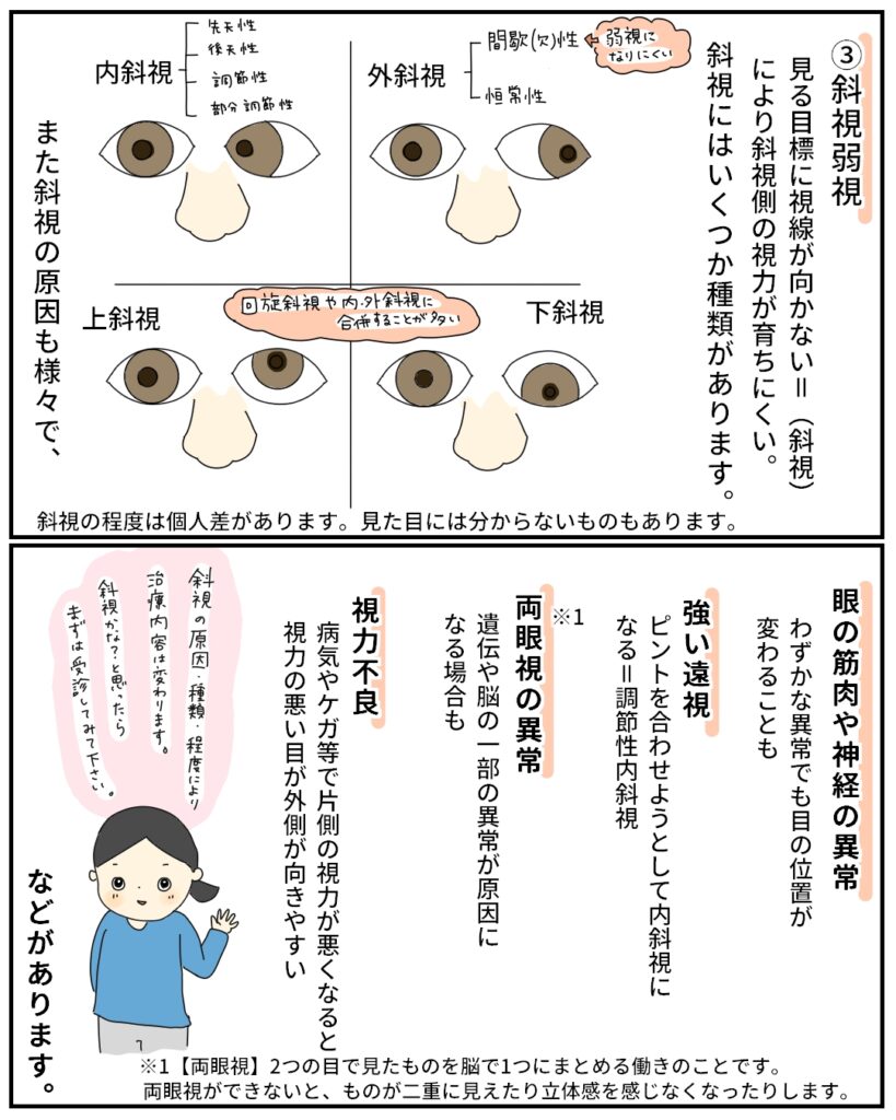 弱視とは？弱視は治療できるの？いつまでなら大丈夫？子どもの弱視を見逃さない【第2話】体験談マンガ まめねこノート